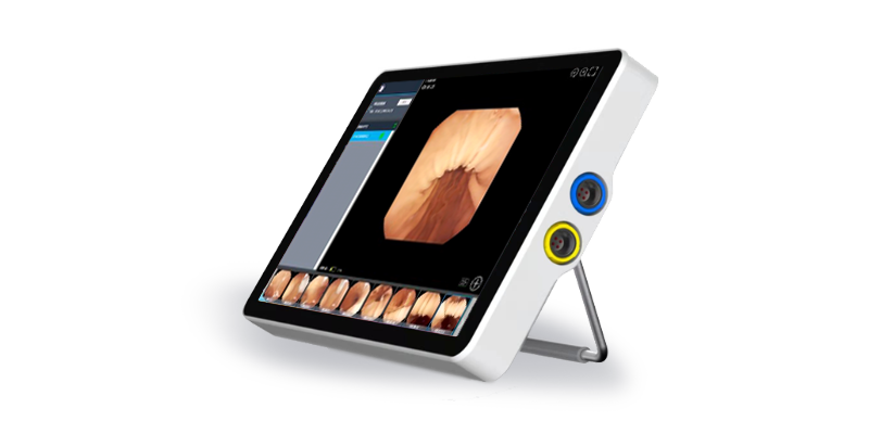 Development and Customization of Endoscopy Host for Five Departments